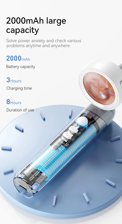 Ear Wax Cleaner Camera for Ears, Nose, & Skin