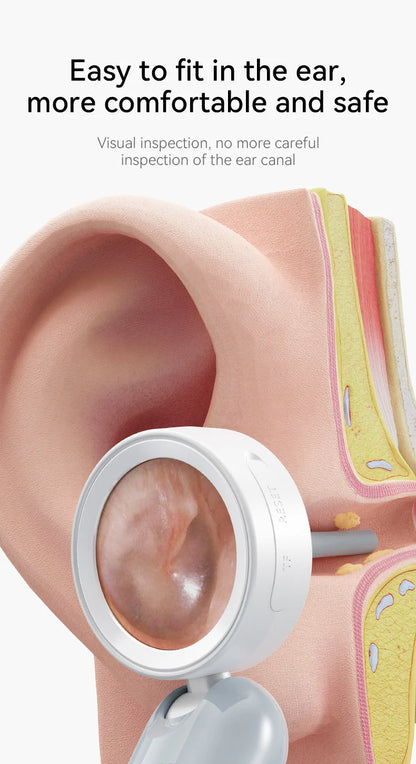 Ear Wax Cleaner Camera for Ears, Nose, & Skin