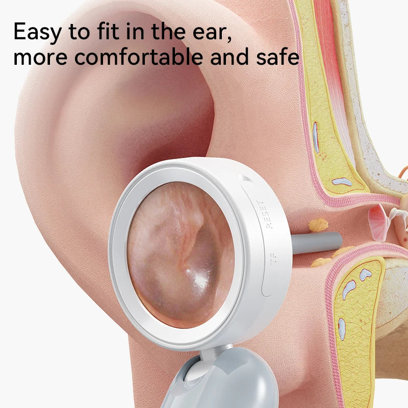 Ear Wax Cleaner Camera for Ears, Nose, & Skin